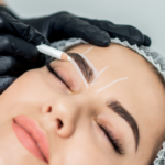 what is a celebrity brow lift